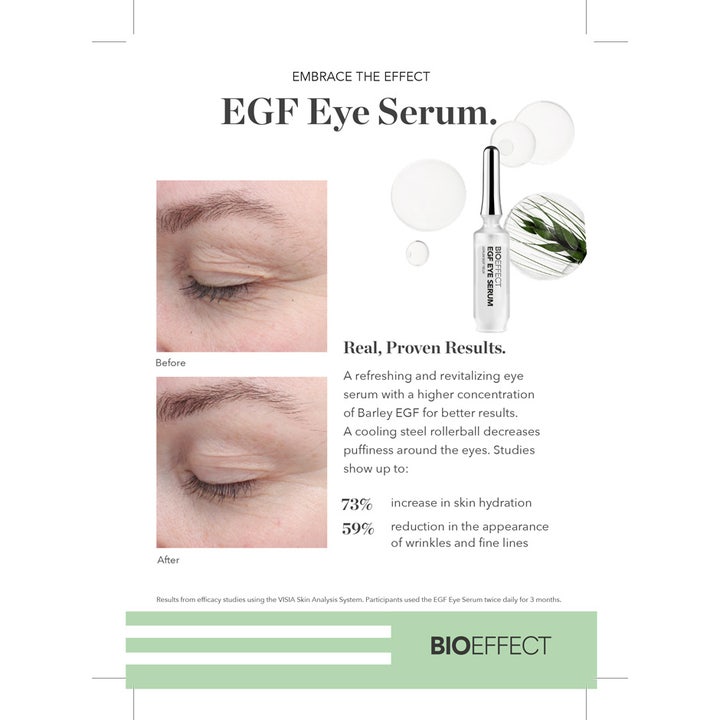 Bioeffect EGF Eye Serum 6 ml silmänympärysseerumi ja tuloksia osoittavat ennen ja jälkeen -kuvat rypyistä.