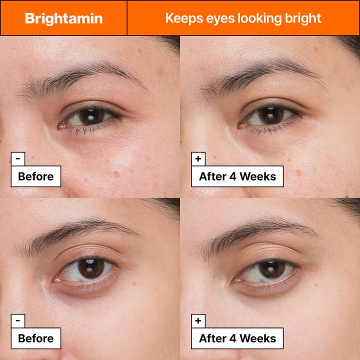 Dr.Jart+ Brightamin Brightening Eye Serum Stick 3,6 g kirkastava silmänympärysseerumi ennen ja jälkeen 4 viikon käytön.