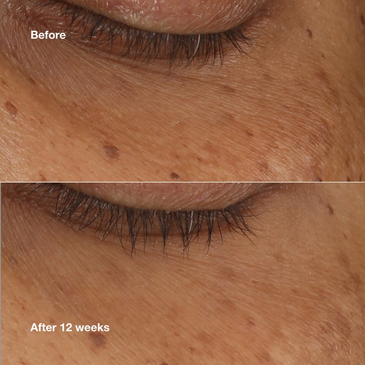 Clinique All About Eyes Brightening Serum Concentrate 10 ml kirkastava silmänympärysseerumi tulokset 12 viikon jälkeen
