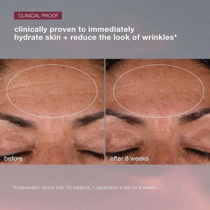 Dermalogica AGE smart Dynamic Skin Recovery SPF50 kosteuttaa ja silottaa otsan ryppyjä 8 viikossa.