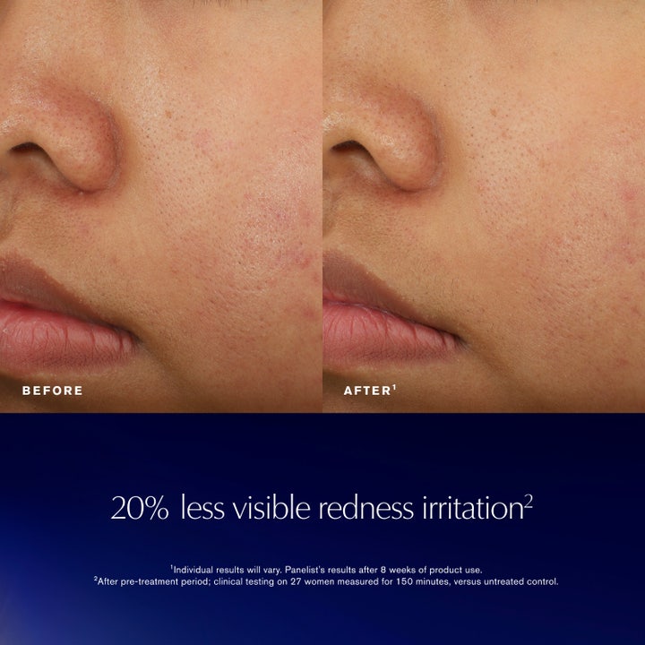 Advanced Night Repair Recovery Treatment Essence