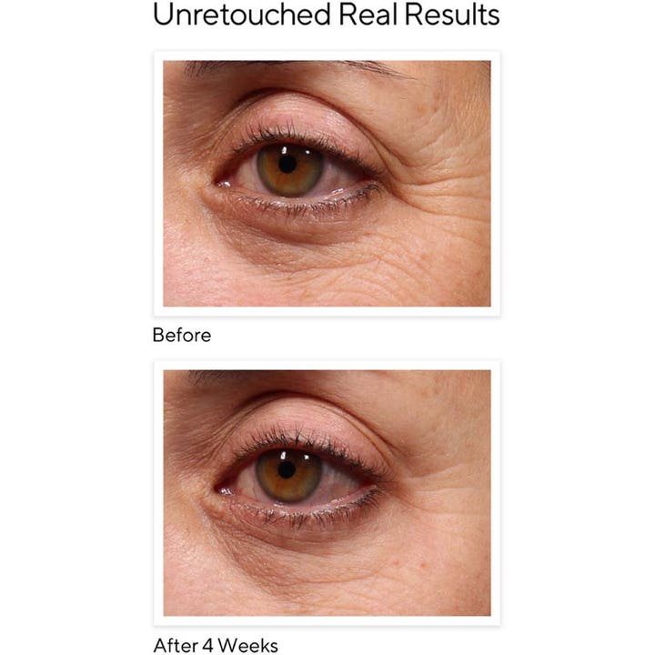 Murad Retinol Youth Renewal Eye Serum 15 ml silmänympärysseerumi silottaa juonteita ennen ja jälkeen kuvissa.