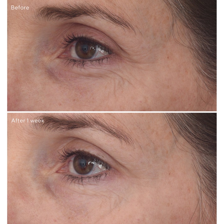 Murad Retinal ReSculpt Eye Lift Treatment 15 ml silmänympärysvoide ennen ja jälkeen tulokset viikon käytöstä.
