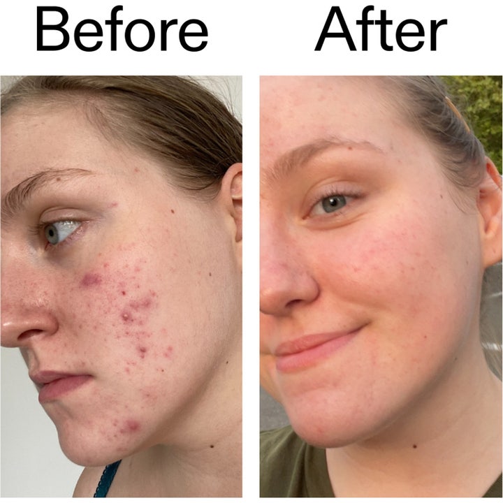 Glycolic Acid Toner