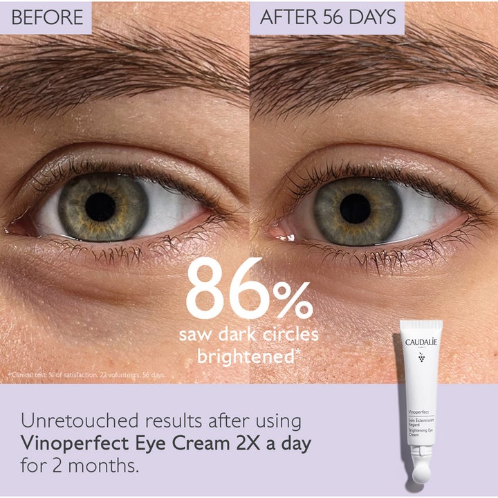 Caudalie Vinoperfect Brightening Eye Cream 15 ml kirkastava silmänympärysvoide ennen ja jälkeen -vertailussa.
