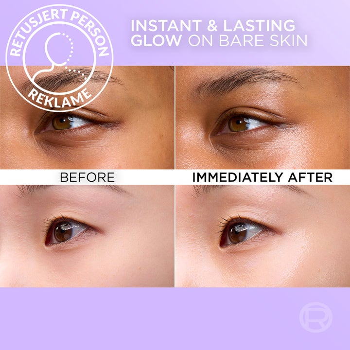 L'Oréal Paris Revitalift Filler 50 ml voide antaa välitöntä hehkua ennen ja jälkeen -vertailukuvassa.