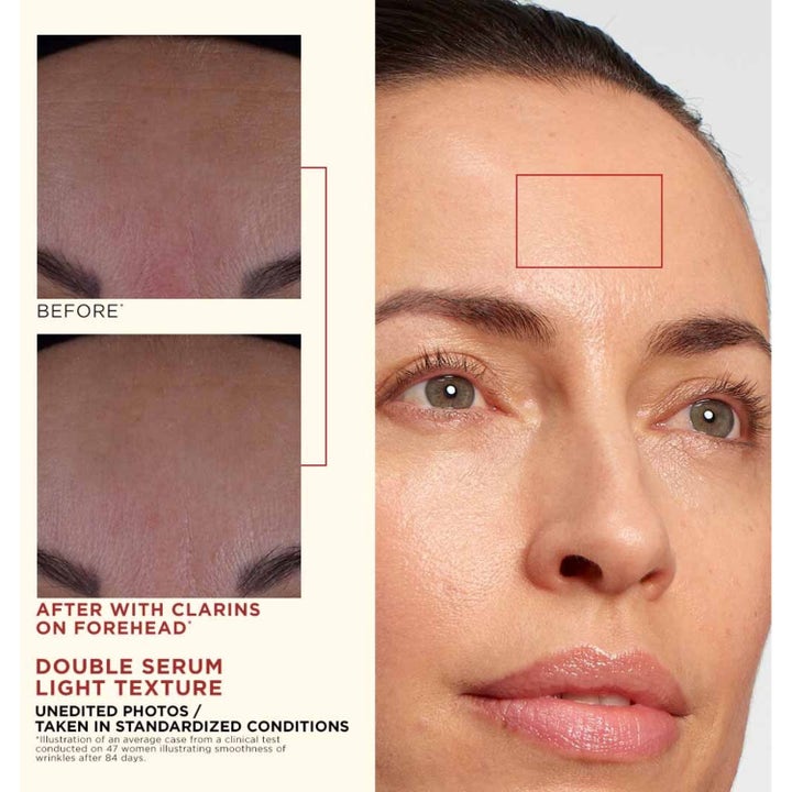 Clarins Double Serum Light Texture 50 ml silottaa otsan ryppyjä ennen ja jälkeen kuvissa.