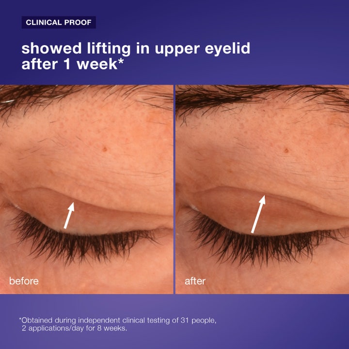 Dermalogica Phyto Nature Lifting Eye Cream 15 ml silmänympärysvoide kohottaa yläluomia ja vähentää ryppyjä näkyvästi.