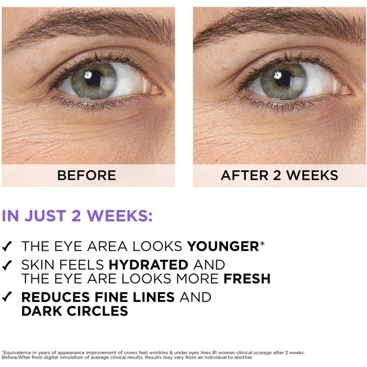 L'Oréal Paris Filler Eye Serum 20 ml silmänympärysseerumi häivyttää juonteita. Ennen ja jälkeen -kuva 2 viikon tuloksista.