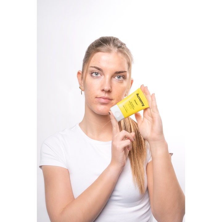 Niche Beauty Lab Acnemy Zitcalm 50 ml rauhoittava kasvovoide keltaisessa tuubissa naisen pitelemänä.