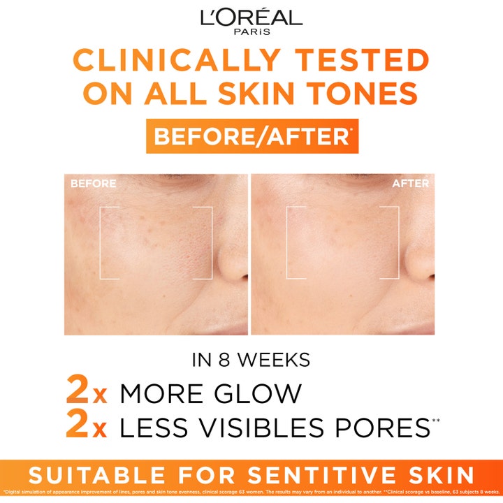 L'Oréal Paris Revitalift Clinical 12% Vitamin C Serum 30 ml kirkastava seerumi ja ennen ja jälkeen kuvat ihohuokosista