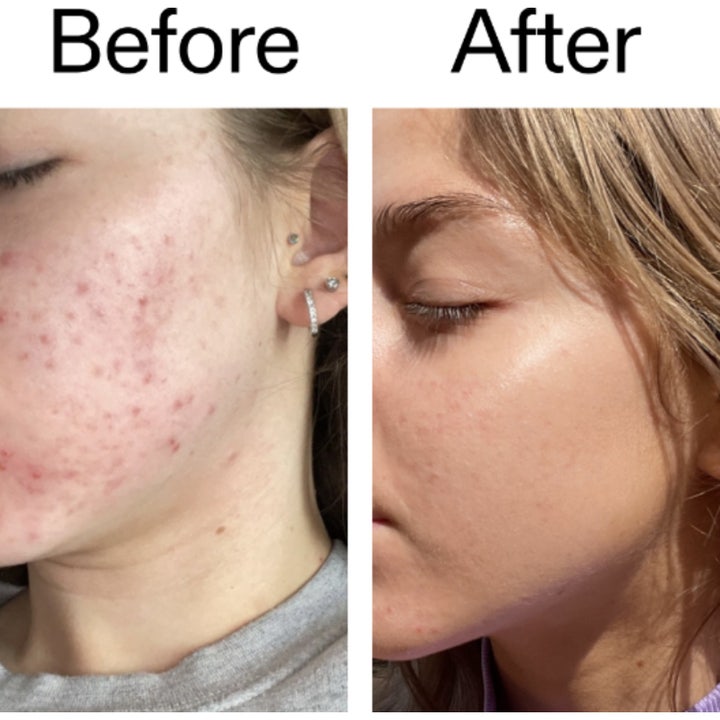 The INKEY List Beta Hydroxy Acid Serum 30 ml puhdistaa ihohuokosia valkoinen pullo ja kirkas geelikoostumus