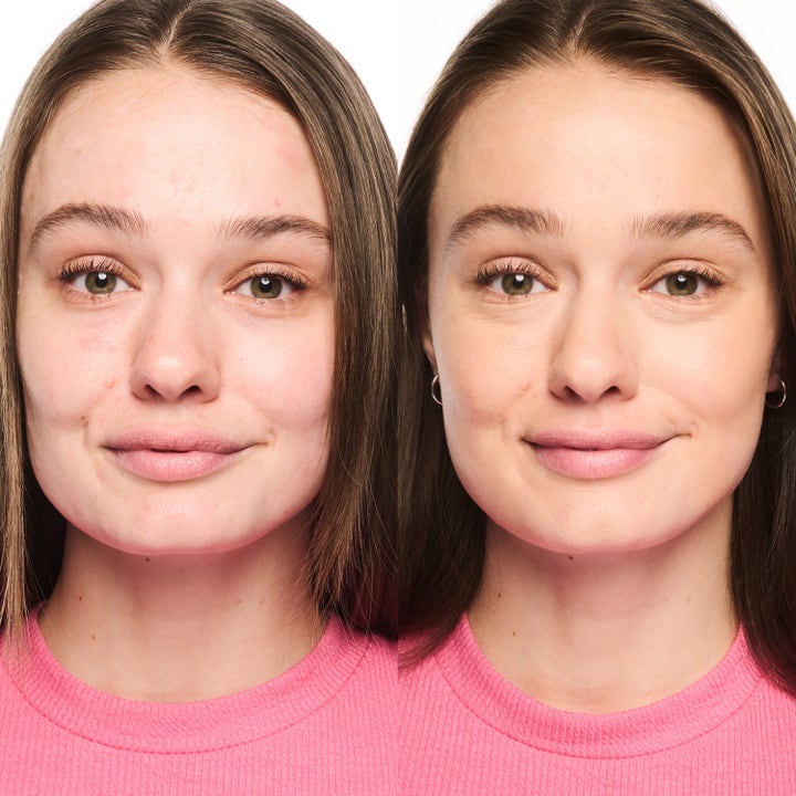 Foundation Stick