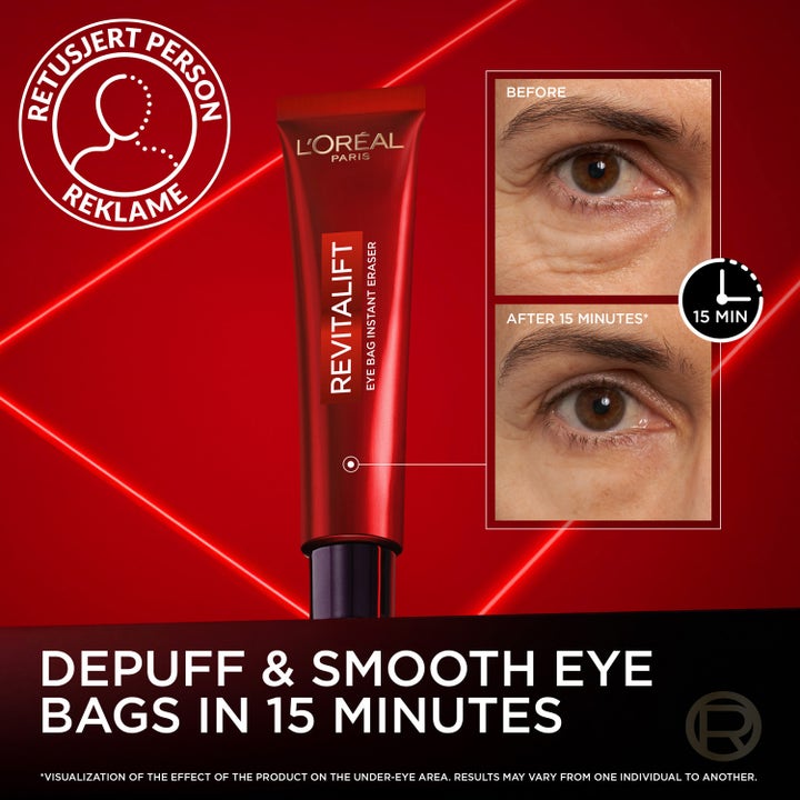 L'Oréal Paris Revitalift Laser Eye Bag Eraser 15 ml silmänympärysvoide ja ennen ja jälkeen kuvat.