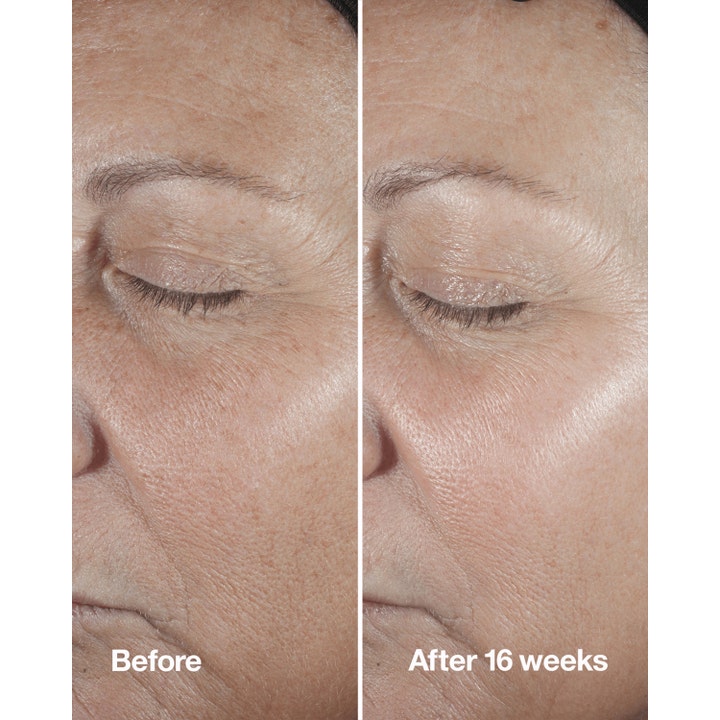 Clinique Smart Clinical Repair Wrinkle Correcting Serum 30 ml silottava seerumi ennen ja jälkeen 16 viikon käytön.