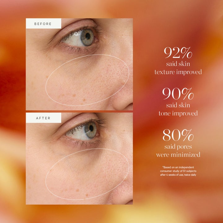 KORA Organics Turmeric Glow Drops 30 ml seerumi ennen ja jälkeen vertailu näyttää tasaisemman ihon tekstuurin.