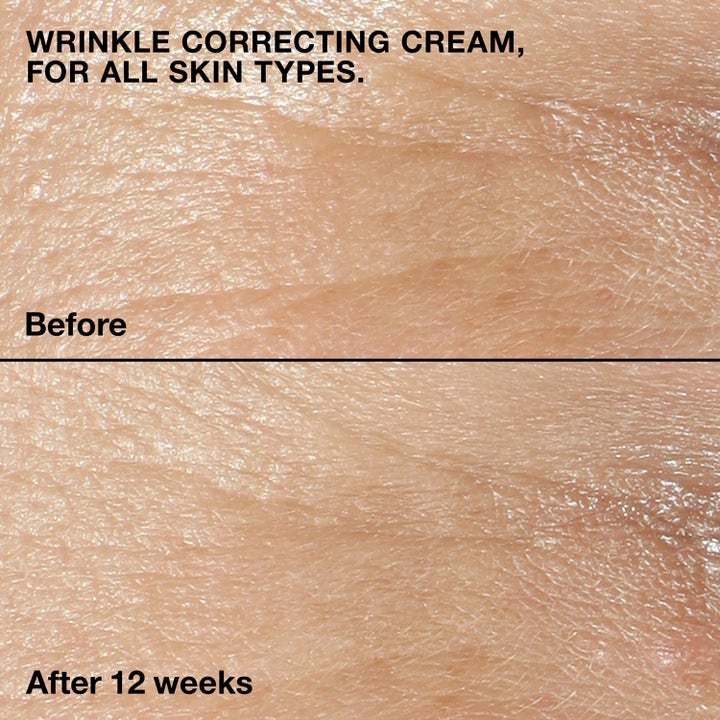 Advanced Wrinkle Correction Duo