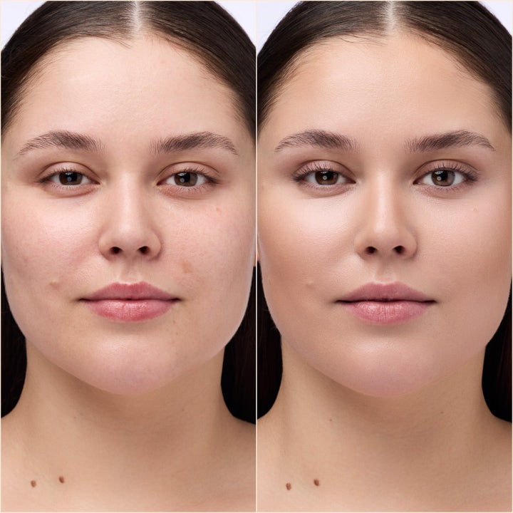 Eye Brightening Set