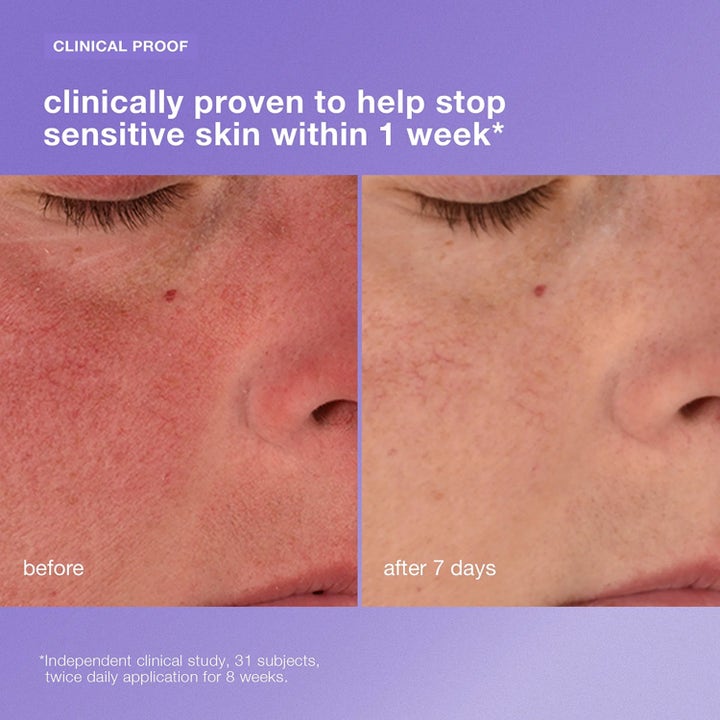 Dermalogica Stabilizing Repair Cream 100 ml rauhoittava kasvovoide vähentää ihon punoitusta viikon käytön jälkeen.