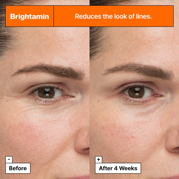 Dr.Jart+ Brightamin Brightening Serum Ampoule 8,08 g kirkastava seerumi vähentää juonteita ennen ja 4 viikon jälkeen