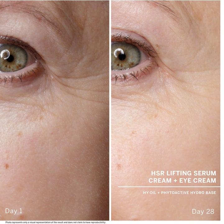 Babor HSR Lifting Serum 30 ml silmänympärysihoa kiinteyttävä seerumi ennen ja jälkeen kuvassa Day 1 ja Day 28.
