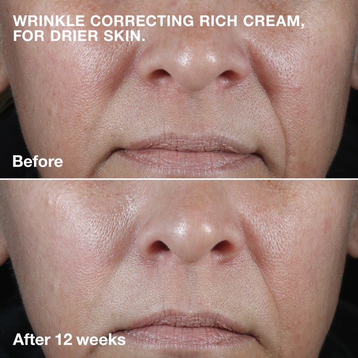 Clinique Smart Clinical Repair Wrinkle Face Cream Rich 50 ml silottaa ryppyjä kuivalla iholla 12 viikon käytön jälkeen.