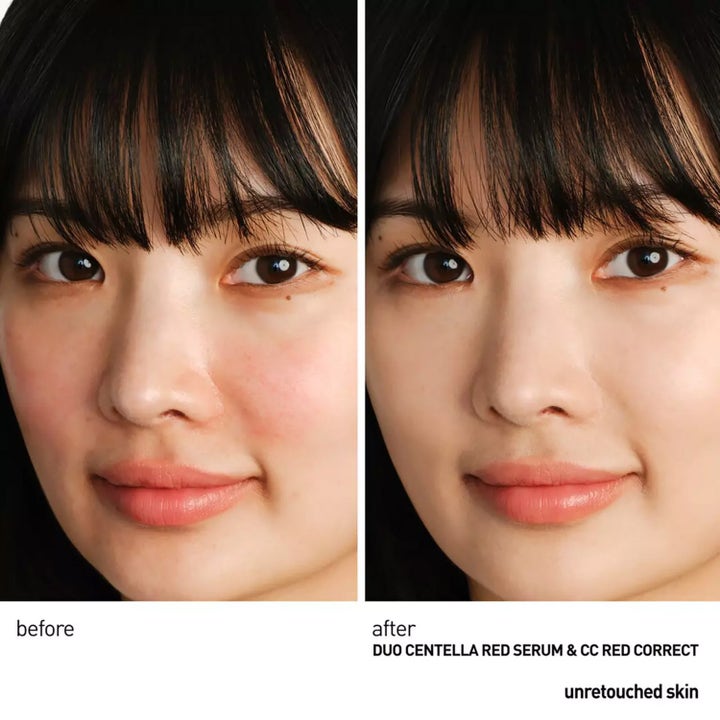 Erborian Centella Red Serum 30 ml rauhoittava seerumi vähentää kasvojen punoitusta ennen ja jälkeen kuvissa.