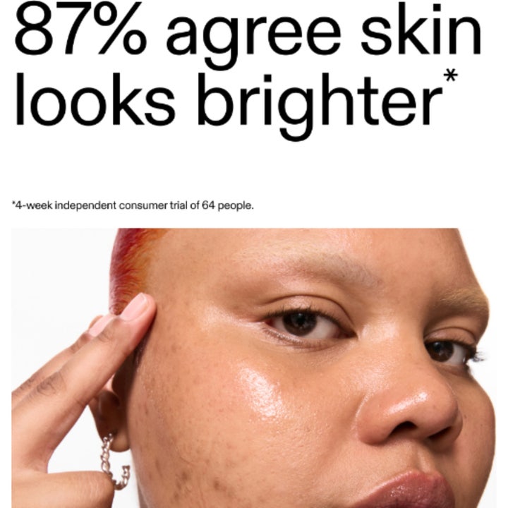 The INKEY List 15% Vitamin C and EGF Serum 30 ml kirkastava seerumi ja teksti 87% agree skin looks brighter.