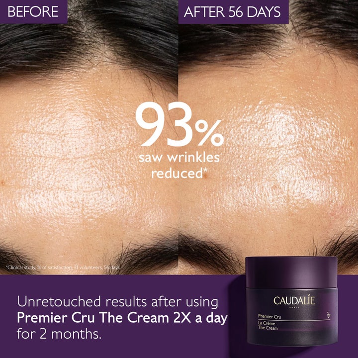 Caudalie Premier Cru The Cream 50 ml silottaa ryppyjä, ennen ja jälkeen vertailukuva otsan ihosta.