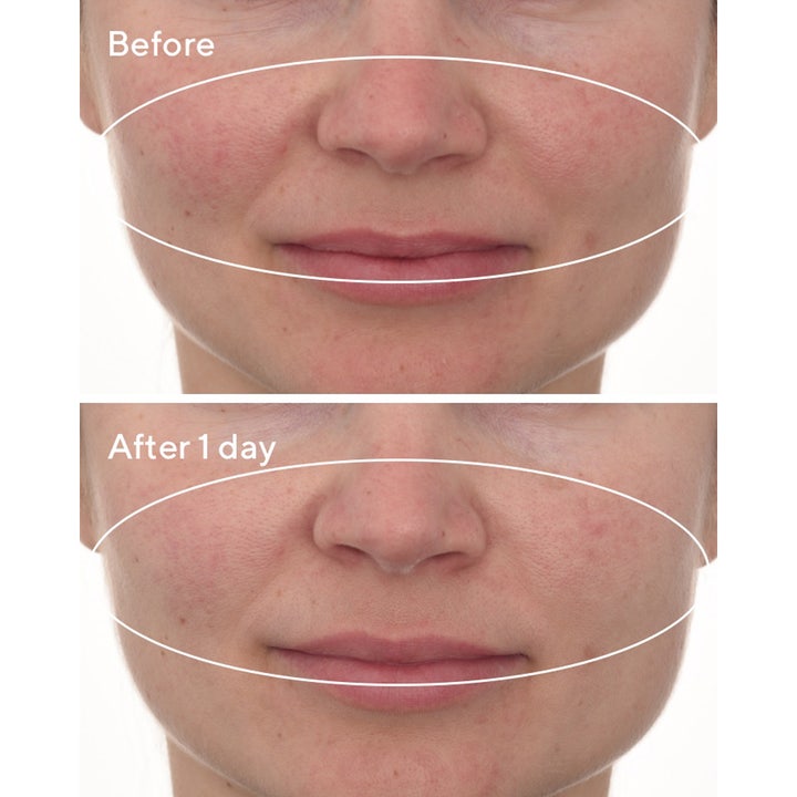 Murad Cellular Hydration Repair Mask 80 ml rauhoittava kasvonaamio vähentää punoitusta ennen ja jälkeen -kuvassa.