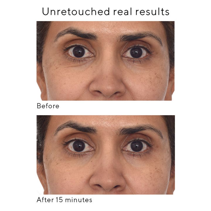 Murad Retinol Youth Renewal Eye Mask 5 kpl silmänympärysnaamio silottaa juonteita 15 minuutin tuloskuvassa.