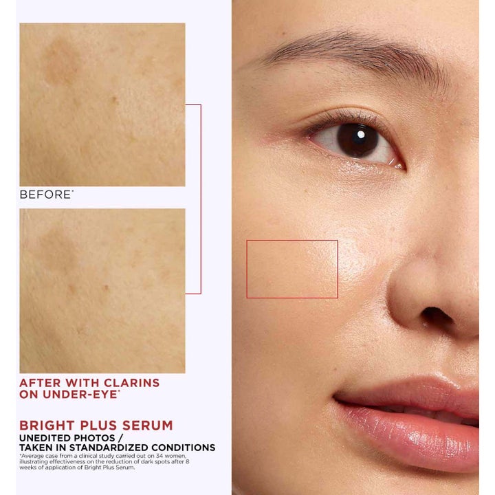 Clarins Bright Plus Advanced Expert Serum 30 ml kirkastava seerumi vähentää tummia kohtia ennen ja jälkeen kuvissa.