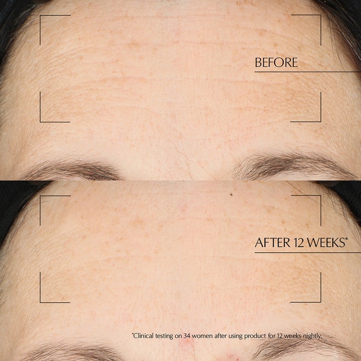 Estée Lauder Advanced Night Repair Overnight Treatment 65 ml kasvonaamio silottaa juonteita ennen ja jälkeen -kuvassa