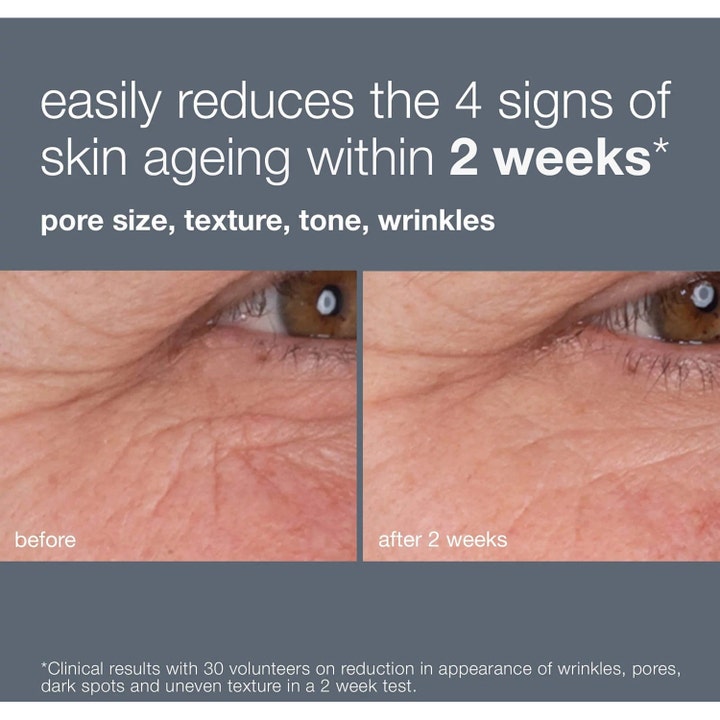 Dermalogica Dynamic Skin Retinol Serum 30 ml silmänympärysihoa silottava ennen ja jälkeen vertailukuva