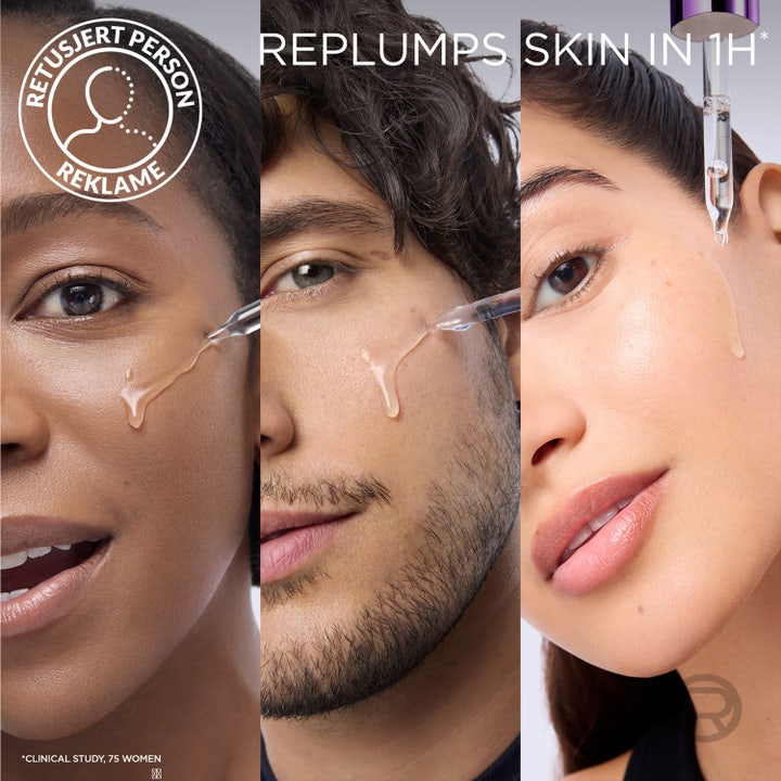 L'Oréal Paris Revitalift Filler 30 ml täyteläistävä hyaluronihapposeerumi levitettynä kasvoille pipetillä