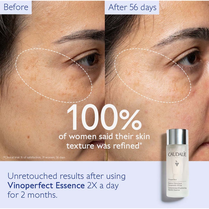 Caudalie Vinoperfect Concentrated Glycolic Essence 100 ml hoitoneste kirkastaa ja tasoittaa ihon tekstuuria 56 päivässä.