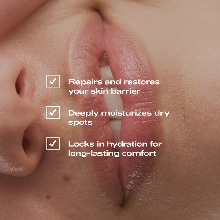 Bodyologist Beyond Balm Intense Repairing Lip & Skin Balm 10 ml lähikuva huulista, jotka se korjaa ja kosteuttaa syvältä.