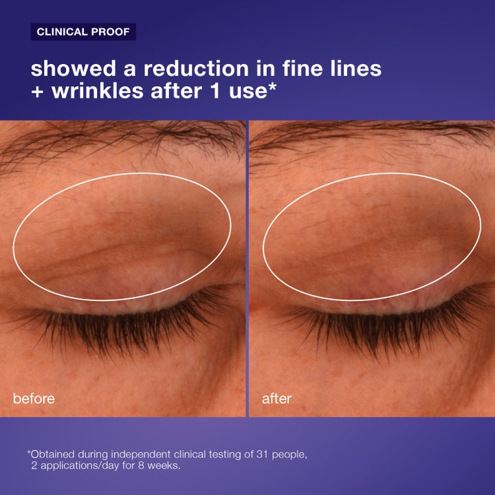 Dermalogica Phyto Nature Lifting Eye Cream 15 ml kiinteyttävä silmänympärysvoide sisältää ihoa silottavaa quinoaa ja peptidejä.