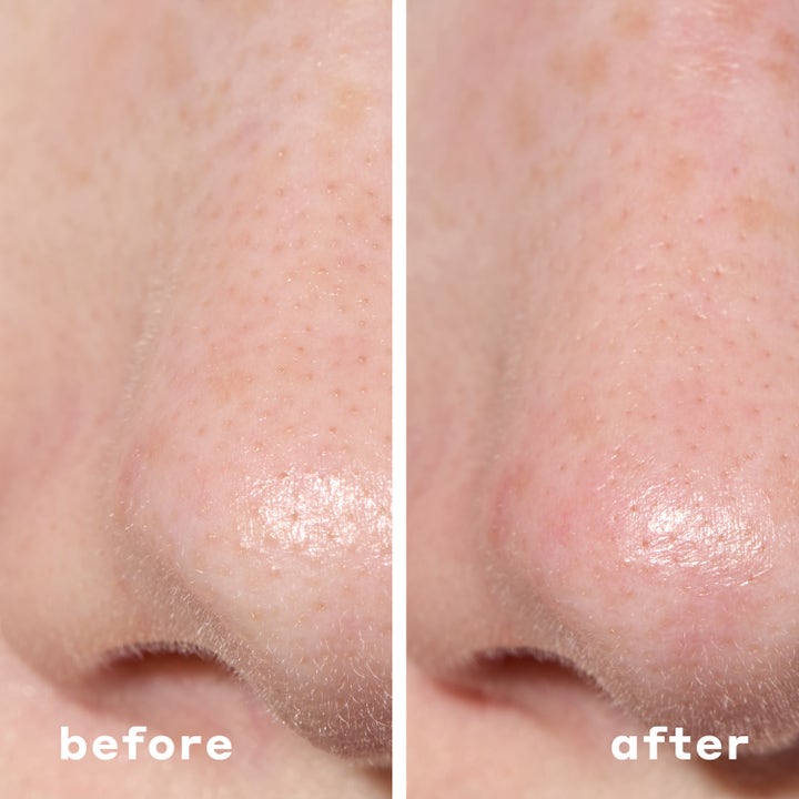Mario Badescu 2-In-1 Deep Cleansing Pore Strip 6 kpl puhdistava laastari vähentää mustapäitä ennen ja jälkeen kuvassa