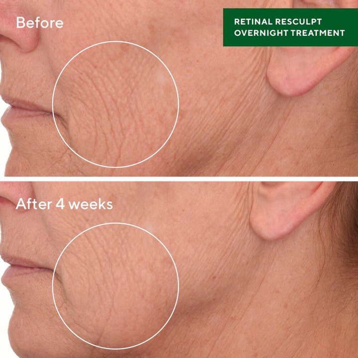 Murad Retinal ReSculpt Treatment 30 ml yöhoito silottaa ryppyjä ennen ja jälkeen 4 viikon käytön