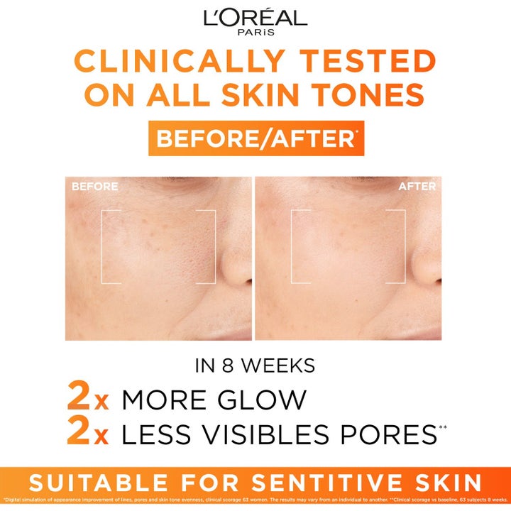 L'Oréal Paris Revitalift Clinical C-vitamiiniseerumi ennen ja jälkeen kuvat ihohuokosista 8 viikossa.
