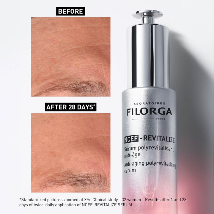 Filorga NCEF-Revitalize Serum 30 ml silottava anti-aging-seerumi hopeisessa pullossa ja 28 pÀivÀn tuloskuva.