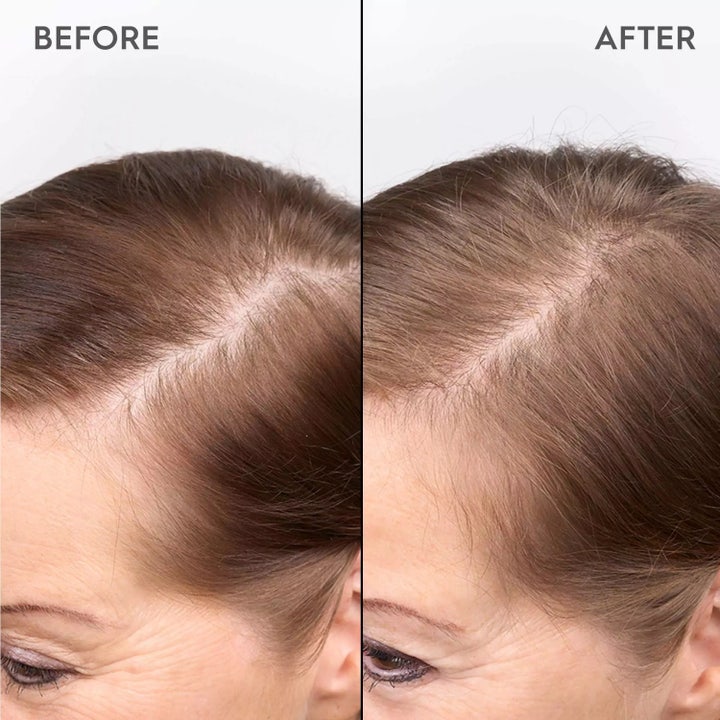 Kerasilk Redensifying Scalp Serum 100ml