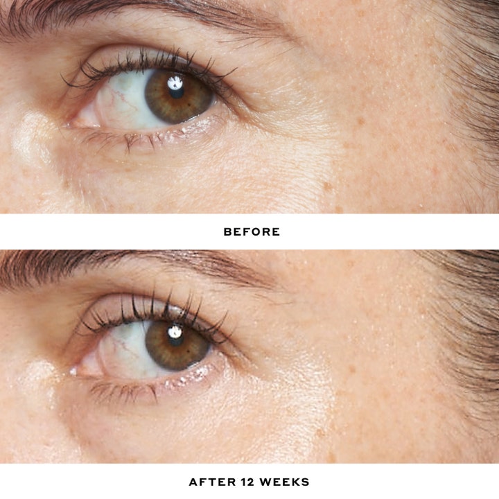 Ole Henriksen Transform Double Rewind 0.3% Retinol Serum 30 ml silottaa ryppyjä ennen ja jälkeen -kuvassa.