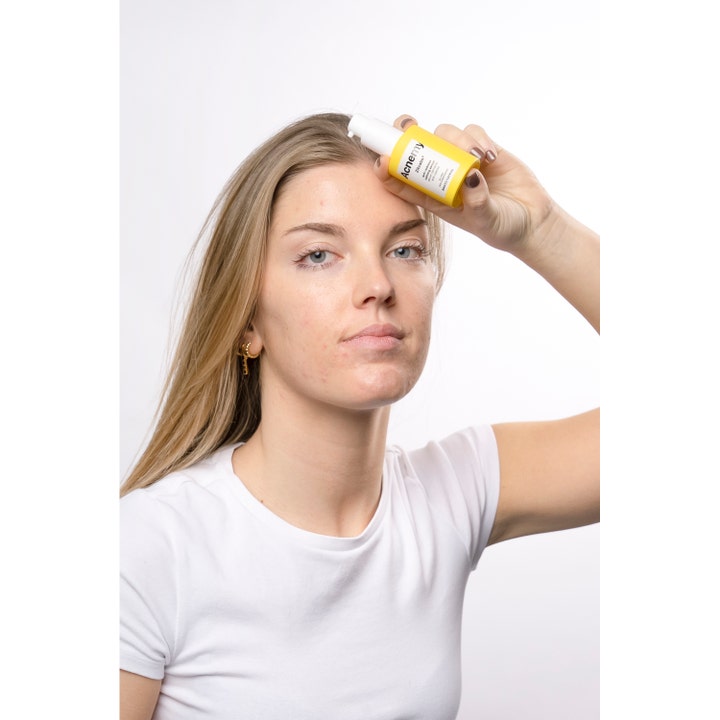 Niche Beauty Lab Acnemy Zitcalm Serum 30 ml rauhoittava seerumi keltaisessa pullossa naisen otsalla.