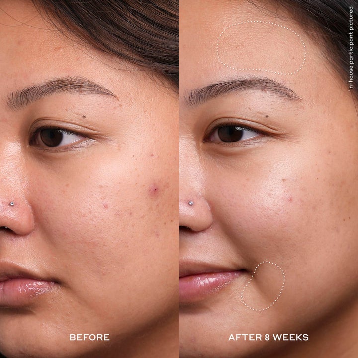 Overnight Renewal & Radiance Duo
