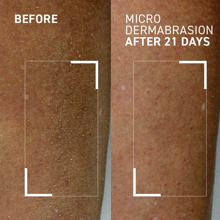 Dr Brandt Microdermabrasion Body Exfoliator 100 g vartalokuorinta silottaa ihoa 21 päivän ennen ja jälkeen kuvassa