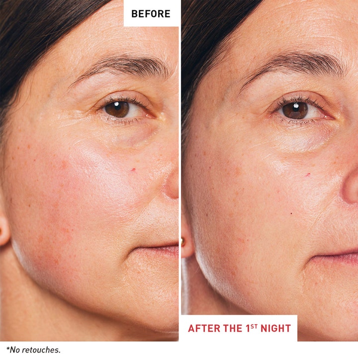 Erborian Skin Therapy Night Oil Serum 30 ml uudistava yöseerumi ja iho ennen ja jälkeen yhden yön käytön