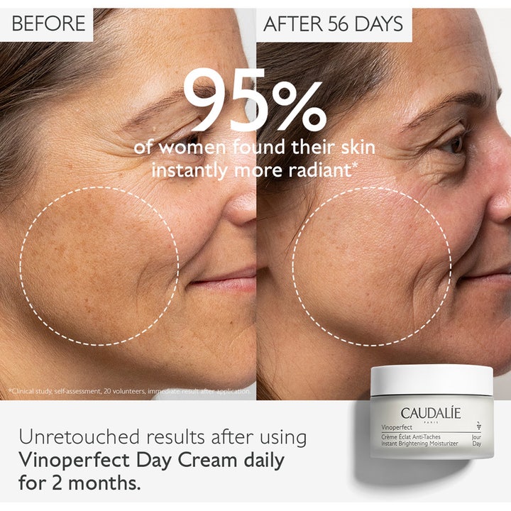 Caudalie Vinoperfect Instant Brightening Moisturizer 50 ml kirkastava päivävoide ja tulokset pigmenttiläiskiin