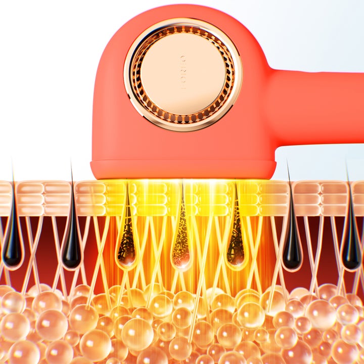 FOREO PEACH™ 2 Pro Max 1 kpl IPL-laite karvanpoistoon jonka valonsäteet kohdistuvat karvatuppiin